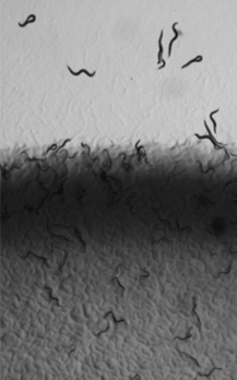 CelegansMicrobacterium